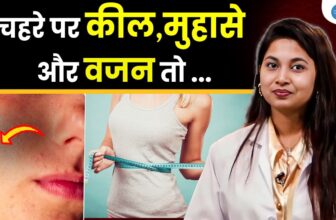 PCOD से छुटकारा कैसे पाएं | PCOS Diet & Workout | Women’s Health Tips | Dr. Akanksha | Josh Talk