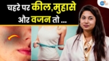 PCOD से छुटकारा कैसे पाएं | PCOS Diet & Workout | Women’s Health Tips | Dr. Akanksha | Josh Talk